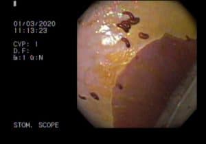 bot flies in horses stomach