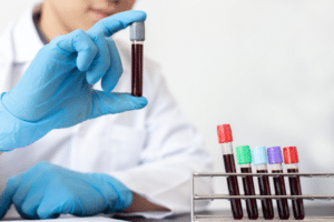 how to test for epm in horses