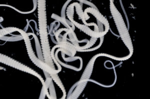 tape worm